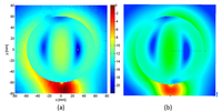 Distribuzioni di campo elettrico ottenute con simulazione elettromagnetica della bobina Fo8 mediante due metodi numerici, FEM (a) e MoM (b).